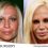 Donatella Versace ha esagerato con la chirurgia estetica?