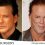 Mickey Rourke e la troppa chirurgia estetica